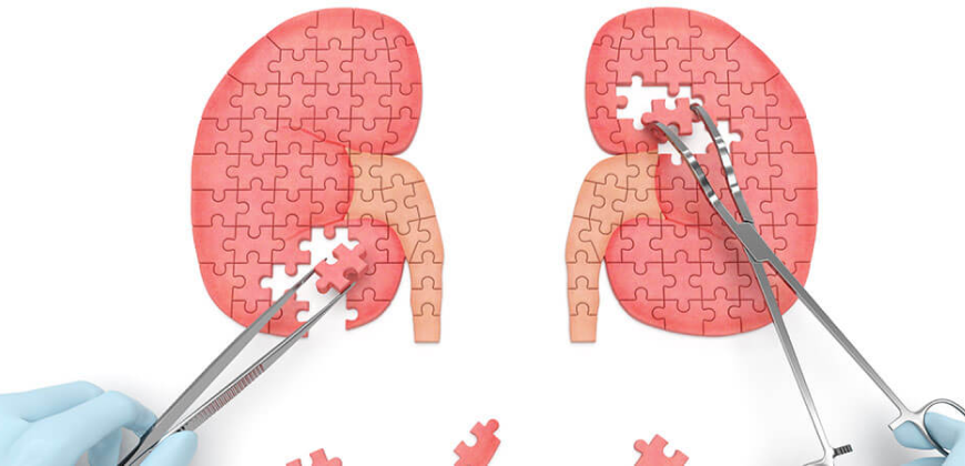 Nephrology & Dialysis